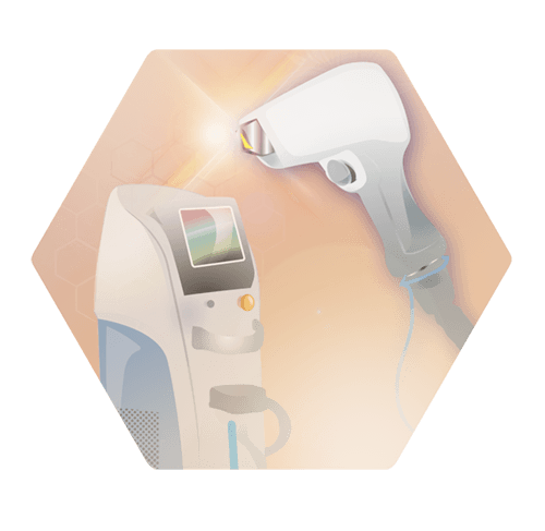 Laser Hair Removal Using a Diode Laser Machine